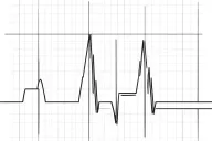 electro cardio graph tattoo design idea