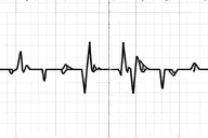 electro cardio graph tattoo design idea